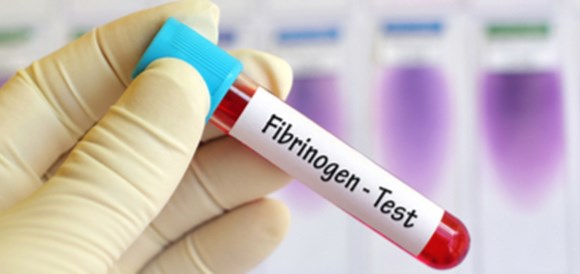 בדיקת פיברינגן (Fibrinogen) - תמונה